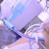 Decontaminants Don’t Cut Bloodstream Infection Risk in Ventilated ICU Patients