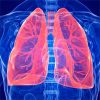 Effect of Bronchodilation, Exercise Training, and Behavior Modification on Symptoms and Physical Activity in COPD