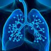New Guidelines for Hospital-acquired Pneumonia/Ventilator-associated Pneumonia