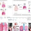 Regeneration of Severely Damaged Lungs Using an Interventional Cross-circulation Platform