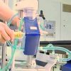Sedation Practice in ECMO-Treated Patients with ARDS