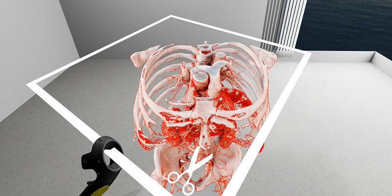 VR Technology for Surgical Procedures Planning