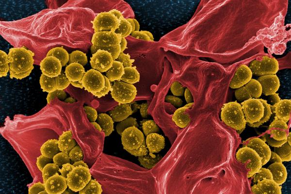 Study shows brute force antibiotics can overcome resistance