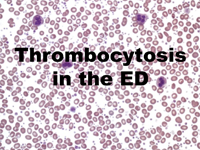 Thrombocytosis in the ED