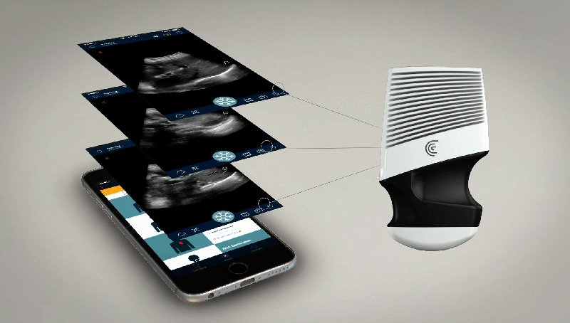 This Handheld Ultrasound Scanner Could Be the Next Stethoscope