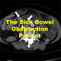 The Sick Bowel Obstruction Patient