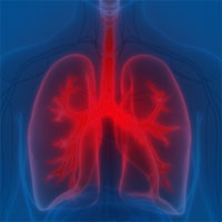 5-year Study Shows Predominance of Non-Device-Associated Pneumonia