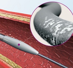 Endexo Additive Technology