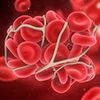 PCSK9 Inhibition and Other New Therapies for Lipid Modification: Good News and Bad