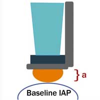 a-concise-overview-of-non-invasive-iap-measurement-techniques