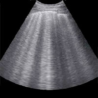 A CT Scanner in Your Pocket? Lung Ultrasonography Beats Chest Radiography