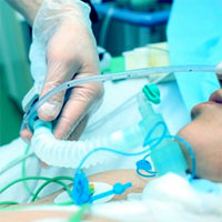 A Protocol of No Sedation for Critically Ill Patients Receiving Mechanical Ventilation