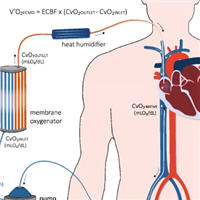 A Rational Approach on the use of ECMO in Severe Hypoxemia