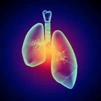 Acute Lung Failure – Our Evolving Understanding of ARDS