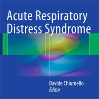 acute-respiratory-distress-syndrome
