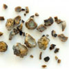 Alpha blockers more effective for large kidney stones