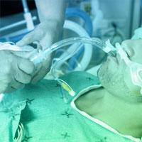 Antibiotic Therapy in Comatose Mechanically Ventilated Patients Following Aspiration