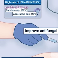 Antifungal Stewardship in Critically Ill Patients