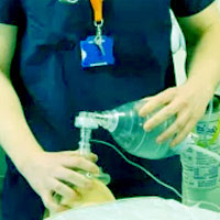 Apneic Oxygenation As a Quality Improvement Intervention in an Academic PICU