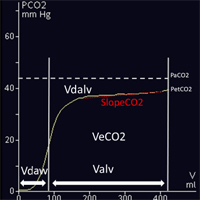 Applied Physiology at the Bedside: Volumetric Capnography