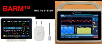 Brain Anesthesia Response Monitor (BARM) by Cortical Dynamics