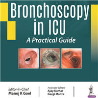 bronchoscopy-in-icu-a-practical-guide