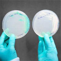Candida Auris a “Perfect Storm” Superbug