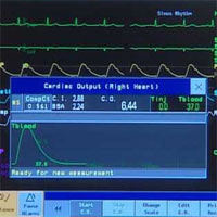 Cardiac Output Monitoring: Throw it Out… or Keep it?