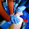 Cardiopulmonary Resuscitation in the Emergency Department During COVID-19