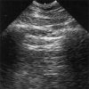 Clinical Assessment of Critically Ill Patients by Whole-body Ultrasonography
