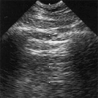 clinical-assessment-of-critically-ill-patients-by-whole-body-ultrasonography