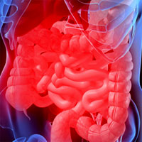 clinical-challenge-in-ibd-expanded-by-systemic-inflammation