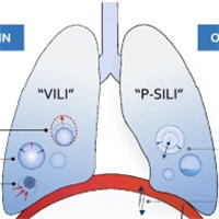 Clinical strategies for implementing lung and diaphragm-protective ventilation