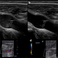Common pitfalls in point-of-care ultrasound: a practical guide for emergency and critical care physicians