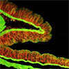 High-Speed Confocal Imaging