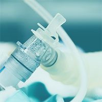Conservative Oxygen Therapy during Mechanical Ventilation in the ICU