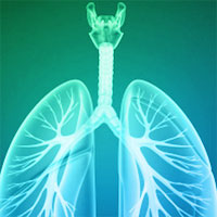 copd-patients-who-live-alone-are-less-active
