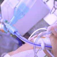 Decontaminants Don’t Cut Bloodstream Infection Risk in Ventilated ICU Patients