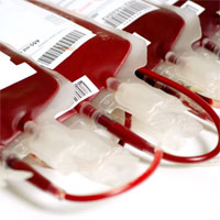 definitive-global-transfusion-study-supports-patient-safety-and-outcomes