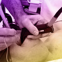 Delayed Intubation Linked to Poor Outcome
