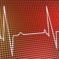 Detecting Undiagnosed Atrial Fibrillation with Cardiac Monitors