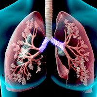 diagnosis-and-management-of-acute-exacerbations-of-copd-pharmacology-cme