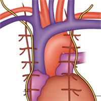 Diaphragm Dysfunction After Cardiac Surgery