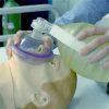 Difficult Bag-Mask Ventilation in Critically Ill Children Is Independently Associated With Adverse Events