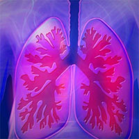 Why COVID-19 Pneumonia is More Deadly than Typical Pneumonia