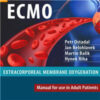 ECMO. Extracorporeal Membrane Oxygenation