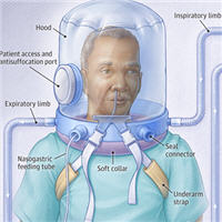 ventilation helmet oxygen noninvasive nasal patients icu