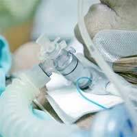 Efficacy and Safety of a Paired Sedation and Ventilator Weaning Protocol in ICU