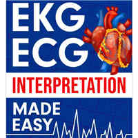 ekg-ecg-interpretation-made-easy