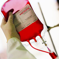 Evaluating Transfusion Strategies